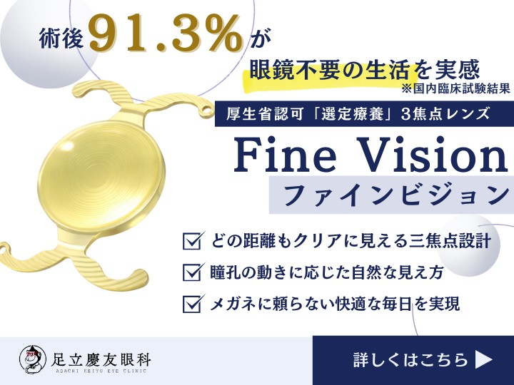 Fine Vision（ファインビジョン）
