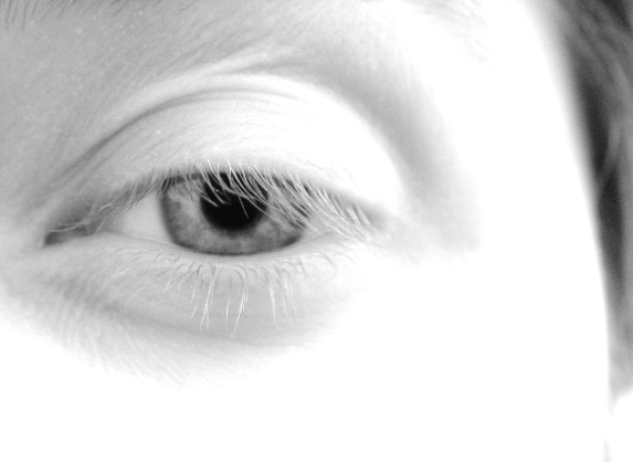 白内障になりやすい人の特徴