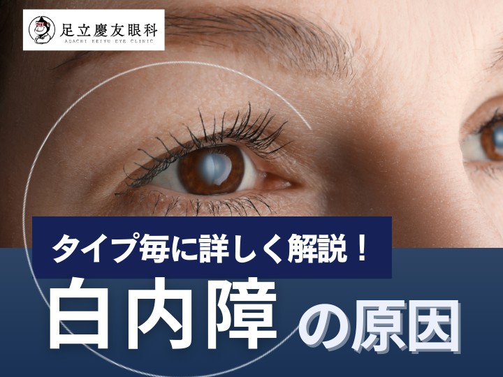 白内障の原因は？