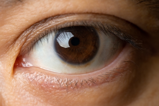 クラレオン パンオプティクス （Clareon PanOptix）とは