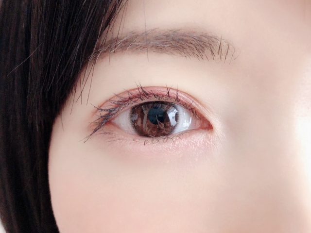 白内障とはどんな病気？